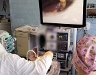 Хирурги онкологического диспансера апробировали новое оборудование
